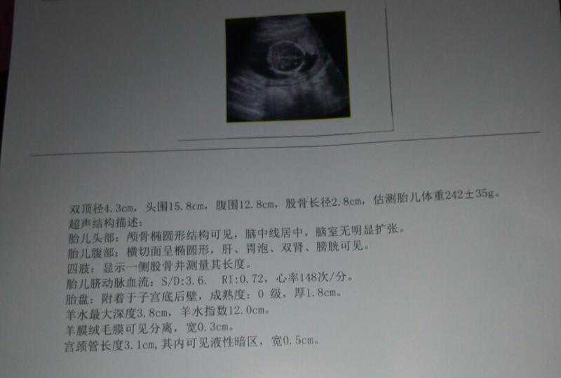 广州代孕助孕哪里好，广州哪里可以做第三代试管婴儿？